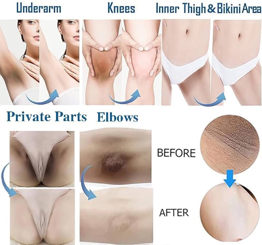 Whitening Cream for Sensitive Areas underarm 7 days result cream.