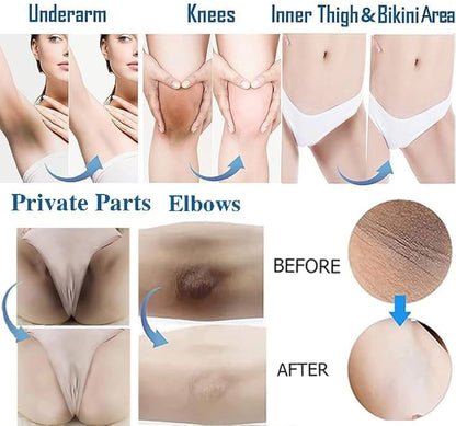 Whitening Cream for Sensitive Areas  underarm 7 days result cream.